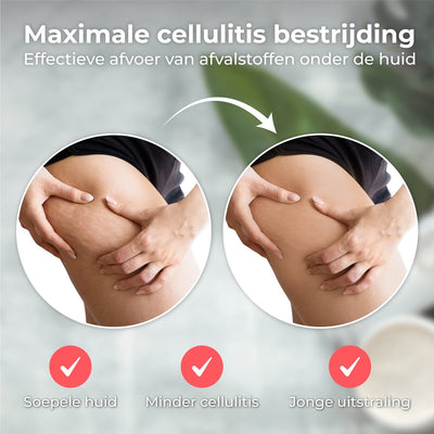 Elektrische Cupper - Cellulitis Massage Apparaat